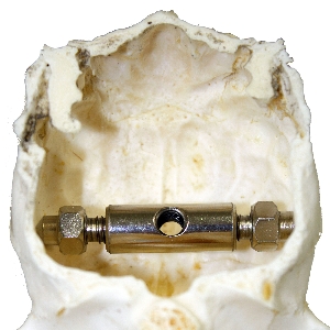 Horn clip for stag 2
